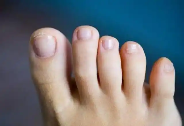 在中国古代小脚趾甲是两瓣的,为何会有不是纯正汉人的传闻?