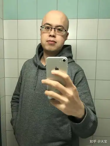 脱发,剃个光头需要多大勇气?