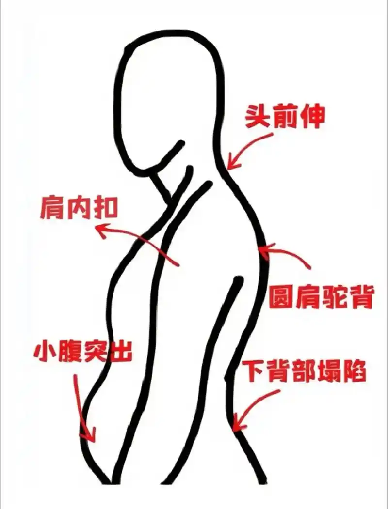 背薄一寸,年轻十岁!含胸驼背,骨盆前倾,小腹突出会让整个人都 - 抖音