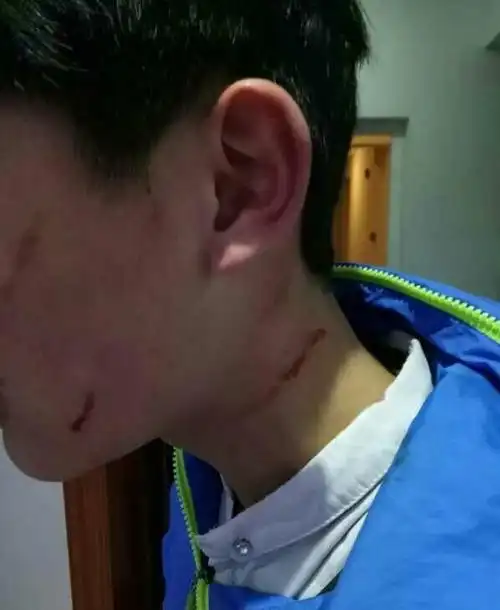 网曝常州某中学老师殴打学生孩子脖子受伤流血