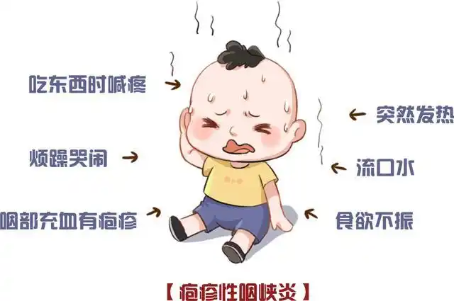 疱疹性咽峡炎大爆发,70%的家长还不知道怎么预防?