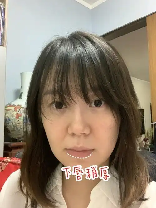 圈子-新氧美容整形