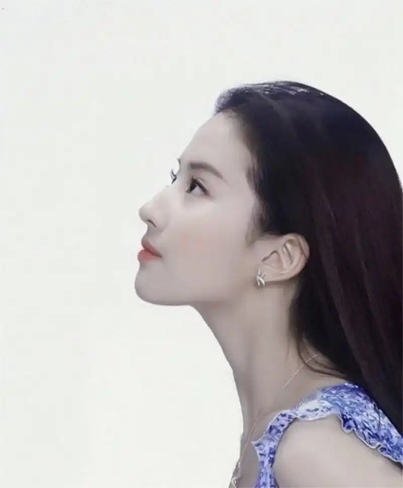 镇江苏王整形——刘亦菲的驼峰鼻