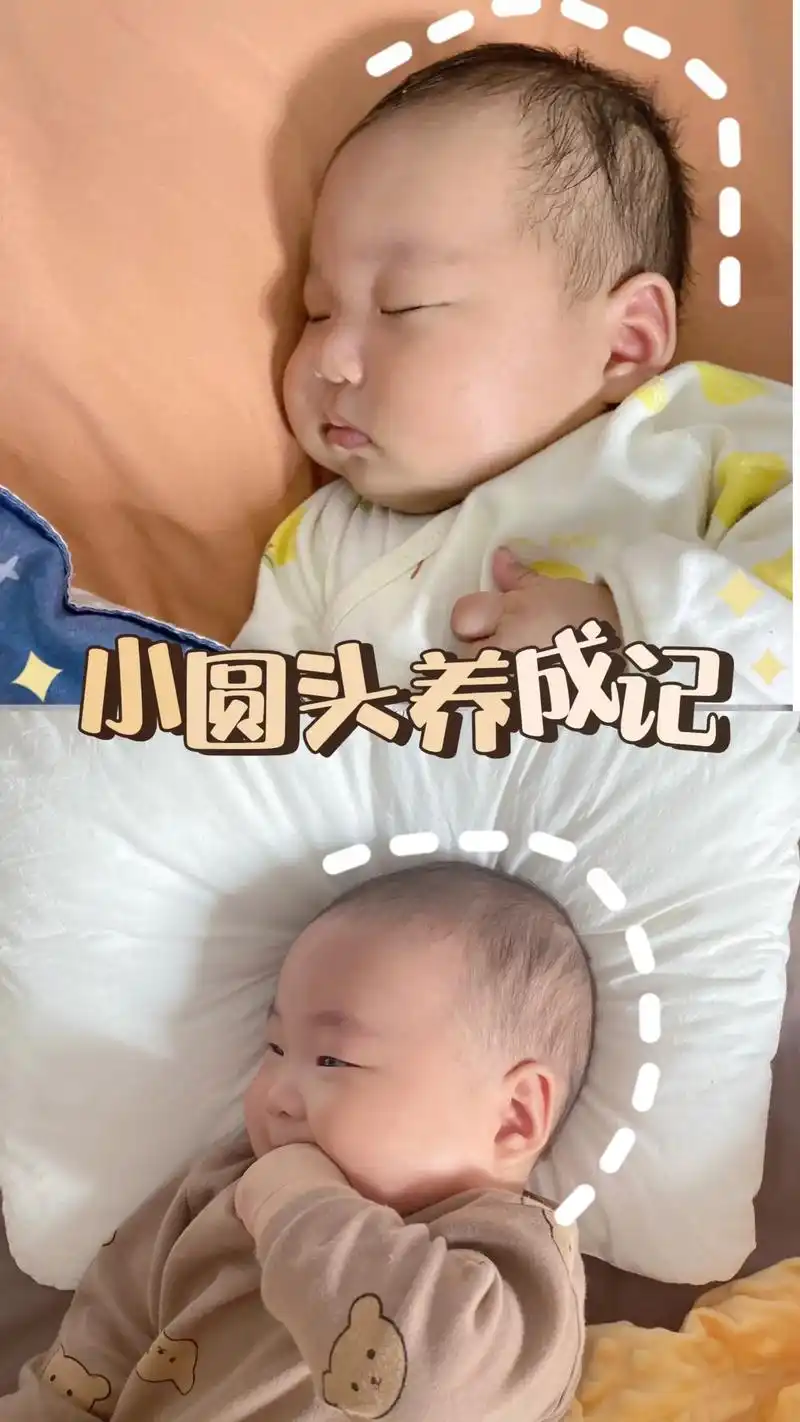 从宝宝出生就为了有个圆头操碎了心,总怕睡扁头或者偏头了,每一 - 抖