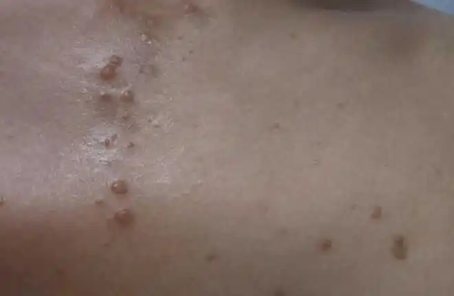 身边这4种男人携带hpv几率偏高,千万别去"招惹",尤其是第一种_宫颈