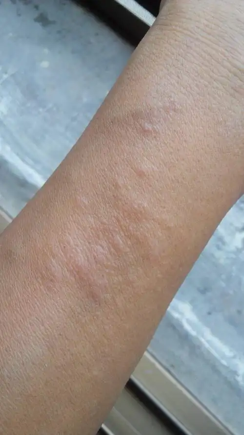 _****** 男29岁|分类:皮肤性病科2014-07-24 17:30 答: 这个