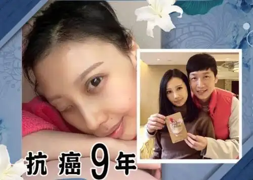 歌手李明蔚患癌去世年仅31因肿瘤造成毁容生前最后照片公开