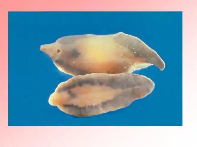 姜片虫,是寄生于人体小肠中的大型吸虫,可致姜片虫病 姜片虫成虫硕大