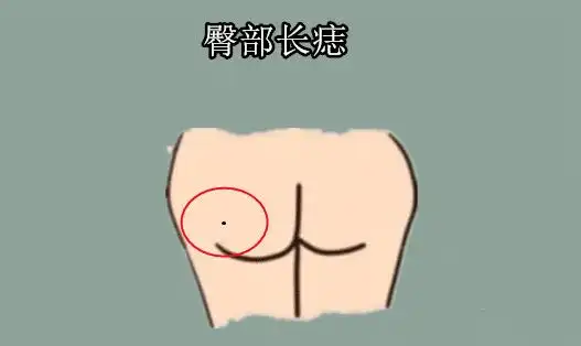 原创身体有这5颗痣早晚会取得成功一辈子都不用为钱发愁担心
