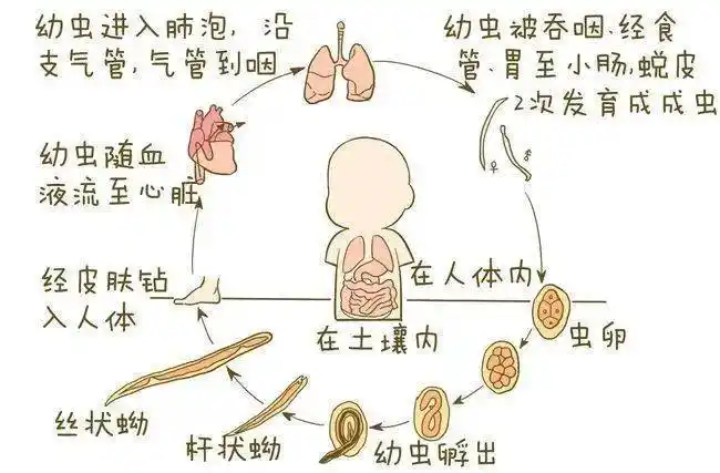 蛔虫蛲虫钩虫孩子容易长的寄生虫你懂吗