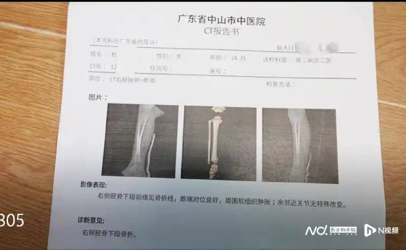 中山两岁男童在托育中心骨折,涉事老师被公安调查