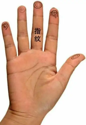 若儿童双手的指腹纹弓形角度大且在六指以