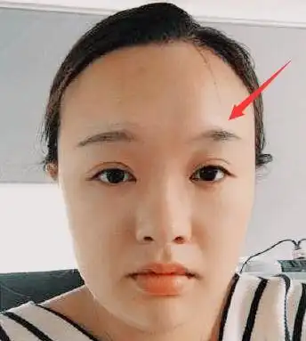 福禄宫有凹陷福德宫在眉尾上方,靠额头发际处,此处若是有凹陷或是纹痕
