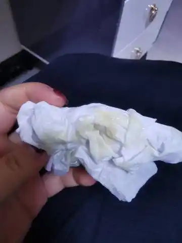 怀孕28周,白带这种正常吗?需不需要去医院?