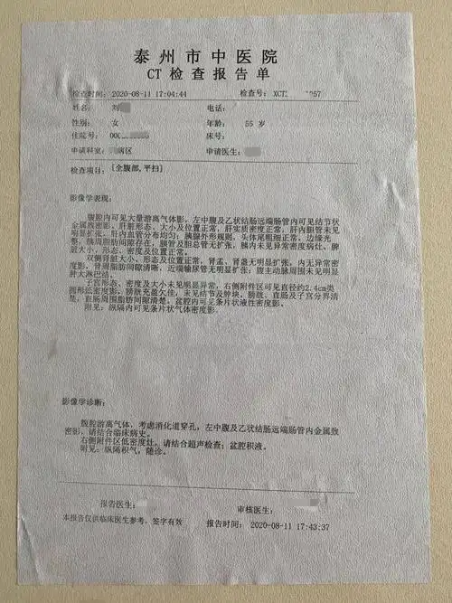 女子在泰州这家医院做胃肠镜检查做出肠穿孔医院30年前剖宫产手术引起