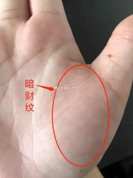 说金星丘有横纹是肠胃不好有没有想过这个横纹还有富贵的含义呢