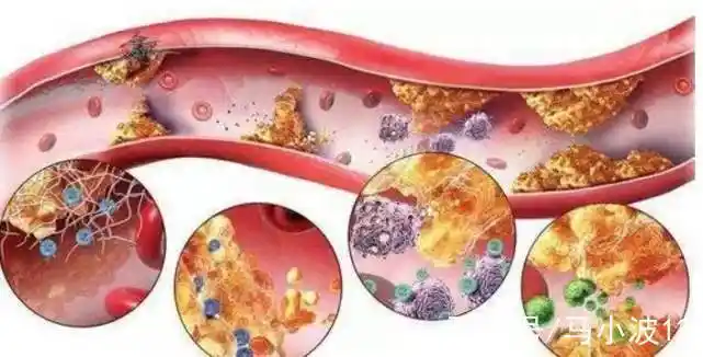 高血脂人要多吃,跟血粘稠说再见,4种神仙食物