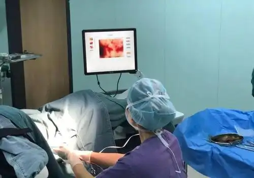 沈医师建议小刘选择可视人流并解释道:可视人流就是在人流术中,通过