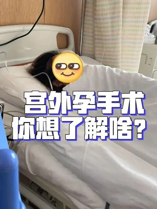 关于宫外孕手术你想了解的都在这