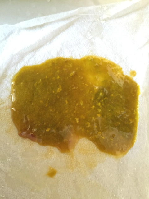 宝宝快六个月了,验便说细菌性痢疾!有经验的宝妈该怎么办啊?