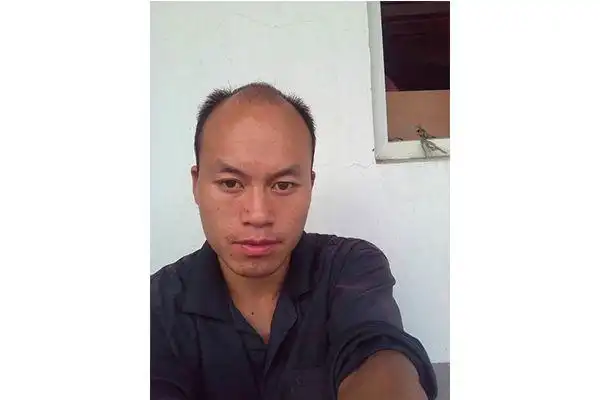 出现秃顶过了40岁,秃顶是很多男性容易面临的情况,这个问题的发生对于