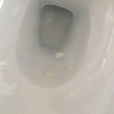 今天上厕所时阴道流出一些乳白色黏稠分泌物 正常吗?有点味道._宝宝树