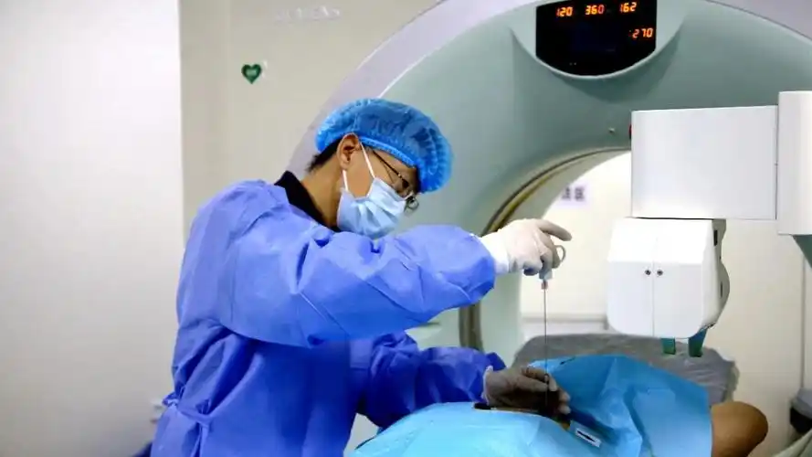 311医院肿瘤介入科微波消融治肺癌