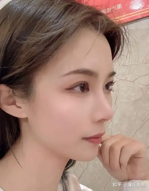 鼻整形 | 直鼻or翘鼻or直鼻微翘?3个核心要点