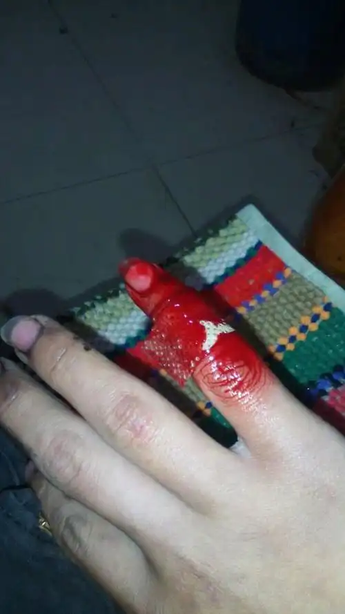 别被划伤怎么处理 路边被划伤保险