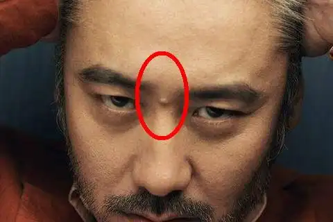 眉间长痣好不好 眉间有痣的命运会如何