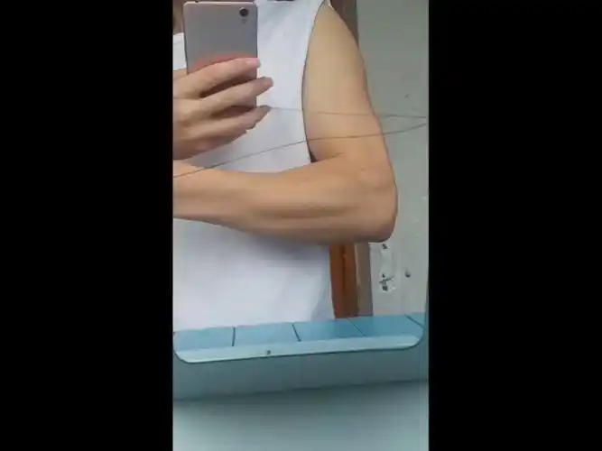 这小臂是拉丝了嘛?大家目测一下小臂多少cm