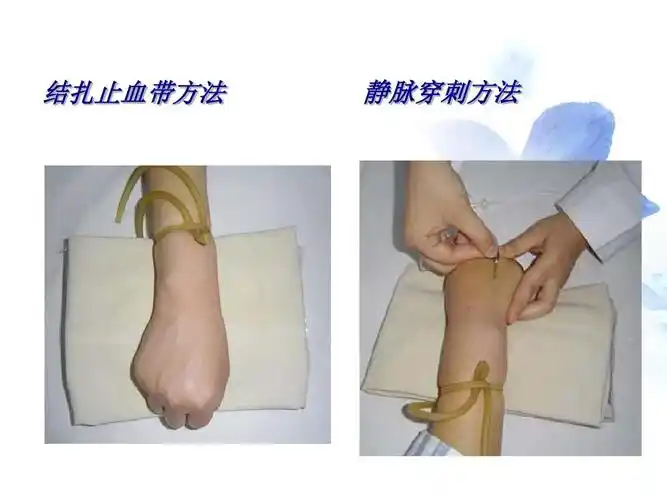 第25页 (共57页,当前第25页) 你可能喜欢 输液护理 留置针静脉输液