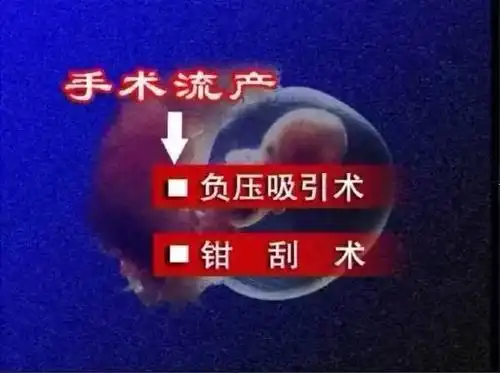 【麻醉学堂】无痛人流知多少——南海区第九人民医院