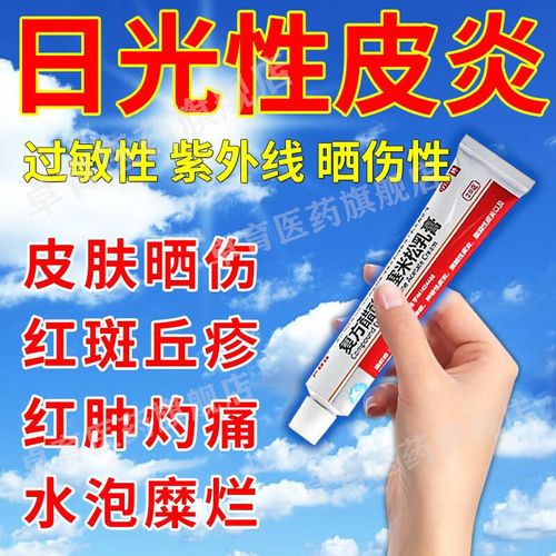 日光性皮肤过敏药皮肤瘙痒止痒药 紫外线过敏药光敏性日光性皮炎复方