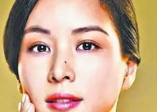 鼻梁上有痣代表什么长了痣会如何