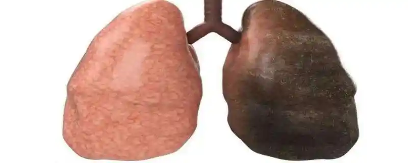 吸烟者的肺戒烟后能恢复吗 吸烟者的肺可以清洗吗