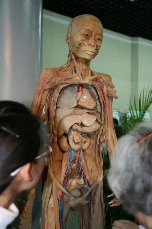人体标本3