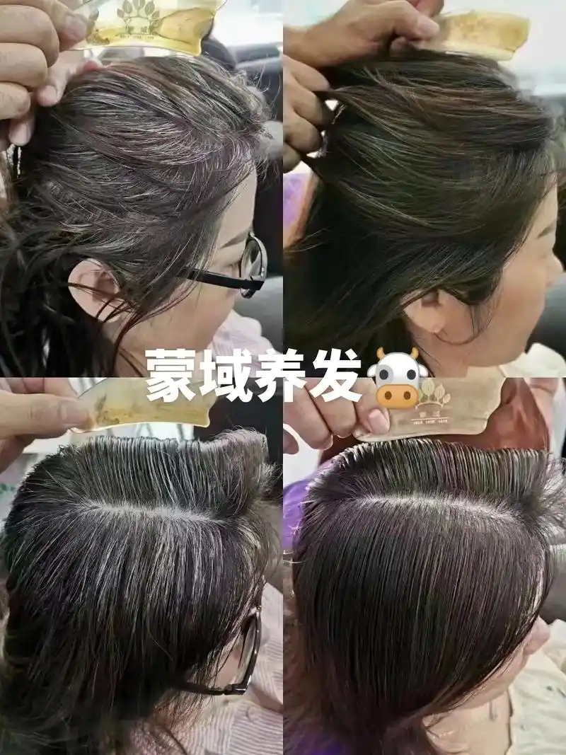 04.77别让白发影响你心情so发 - 抖音