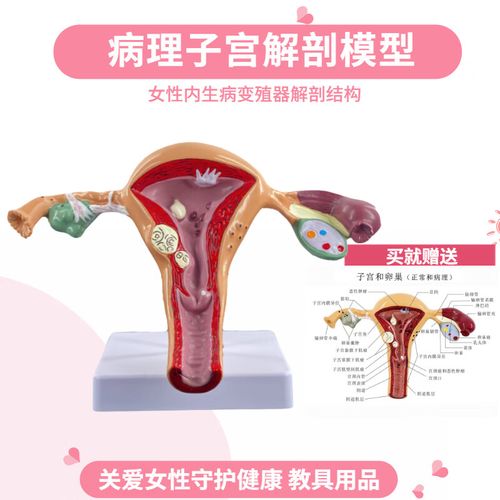 子宫模型女性子宫模型 卵巢模型 女性阴道 女性内生殖器解剖模型 订做