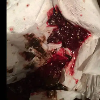 各位宝妈,麻烦给看看这是吐血么?要怎麼办才好啊,求帮忙啊