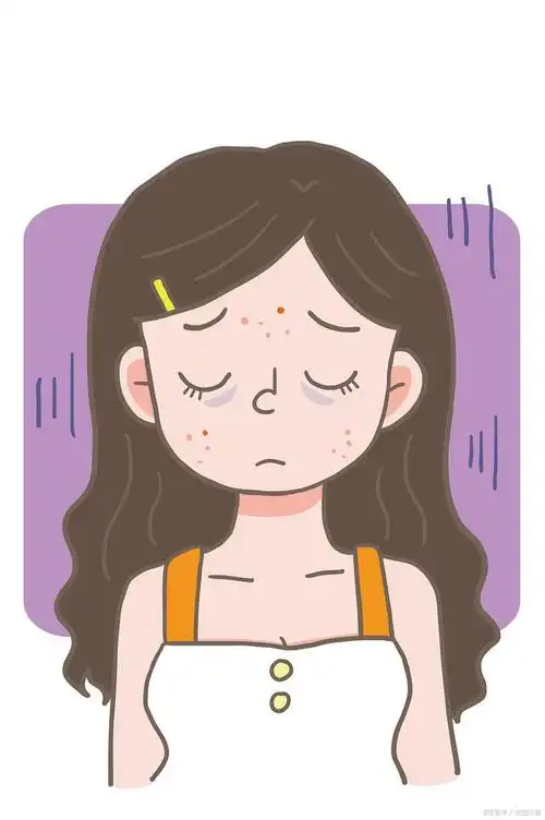 关于痘痘的那些事儿,你知多少?