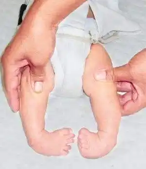 脑瘫训练足内翻的两种训练