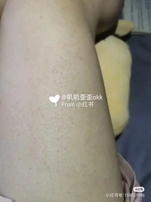 有露出脚脖子以上的皮肤,腿上一颗颗的小黑点一样我怎么好意思露出来