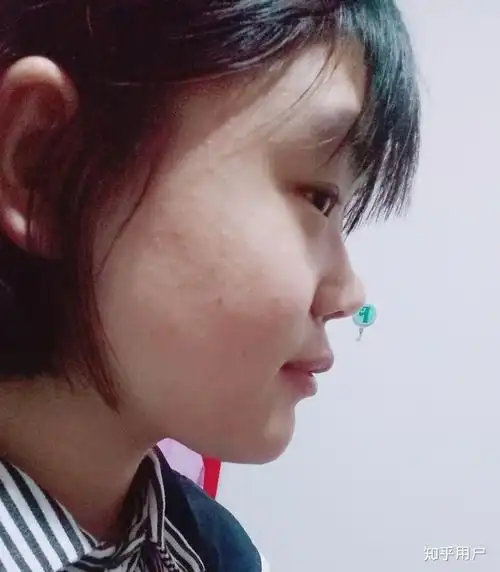 侧脸超级丑是什么体验?