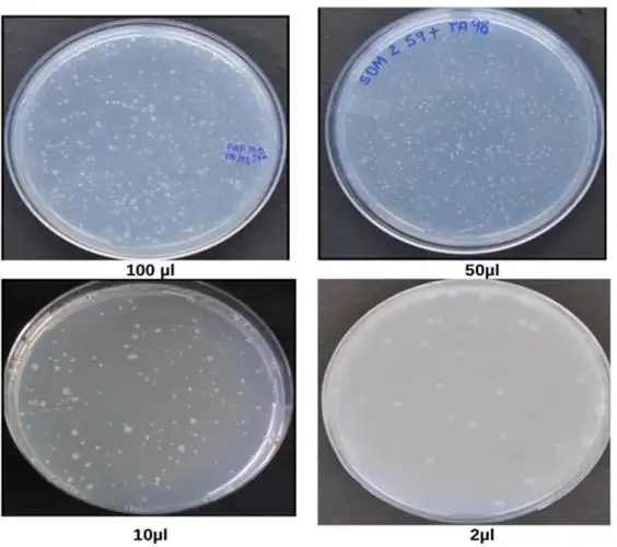 microbial mutagenicity assay: ames test