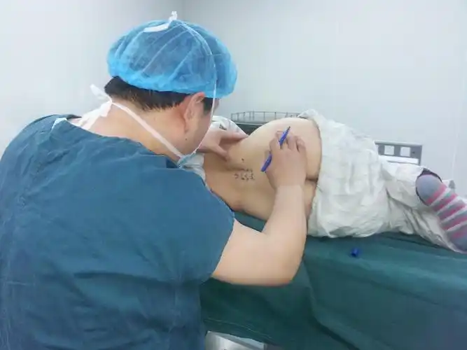 腰椎旁神经阻滞术