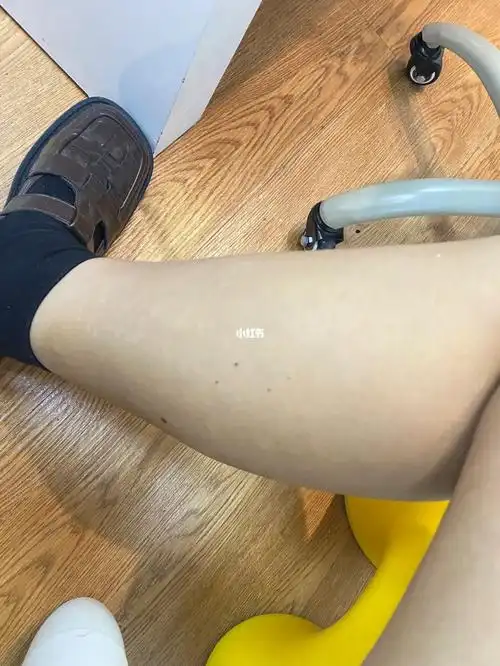 今天打了第三针,刚打完有点涨,一会就没啥感觉了,是不是免疫了哈哈哈