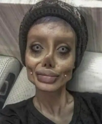 美女整容成瘾数年之间将自己的脸换了一个人百万网友都尴尬