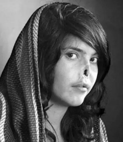 揭秘古埃及酷刑割掉鼻子杀死他们的孩子3