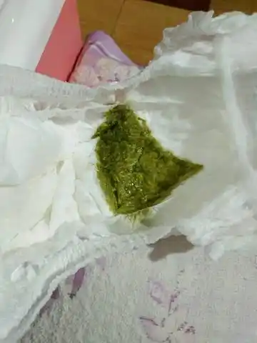 宝宝拉绿屎